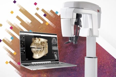 Radiografia ai denti: arriva la Tac Cone Beam.